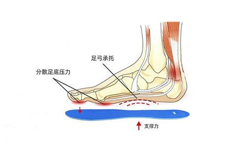 定制鞋垫