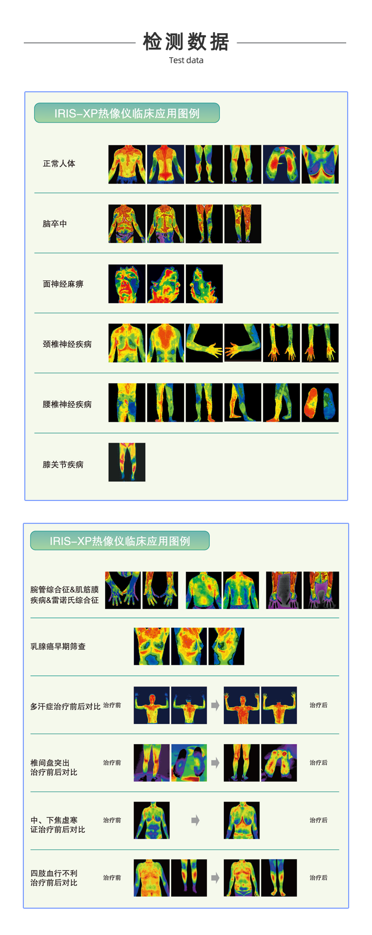 医用红外热像仪