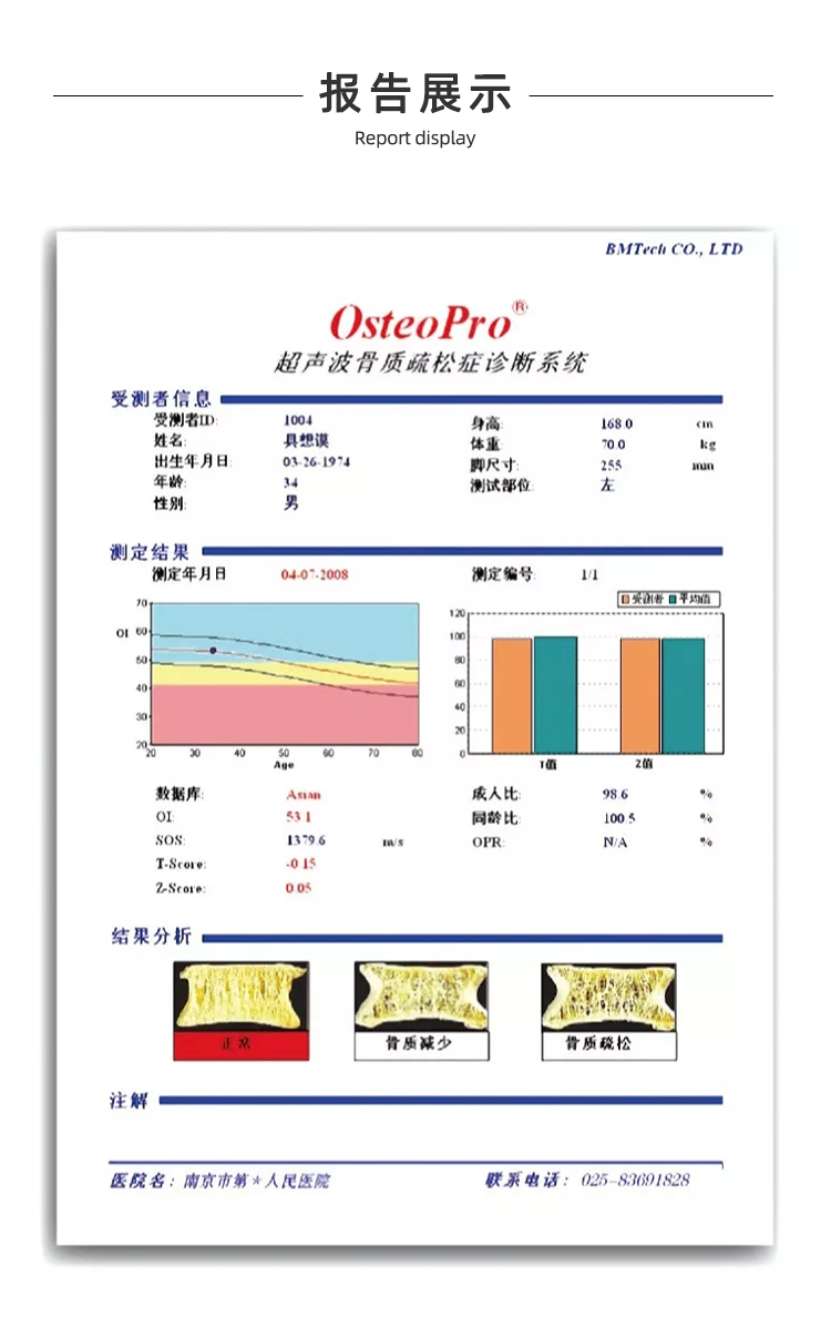 超声骨密度仪
