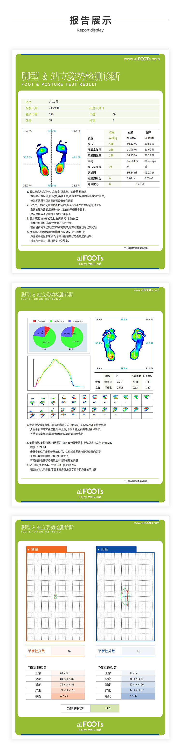 足底压力分析仪