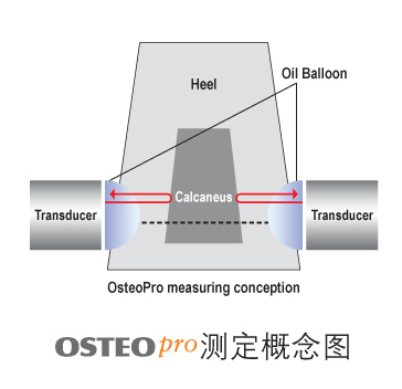 韩国骨密度仪测定概念图
