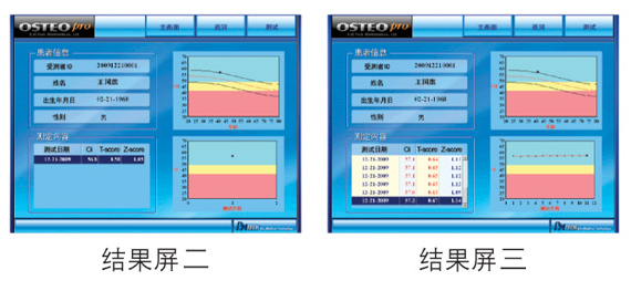 韩国骨密度仪检测结果