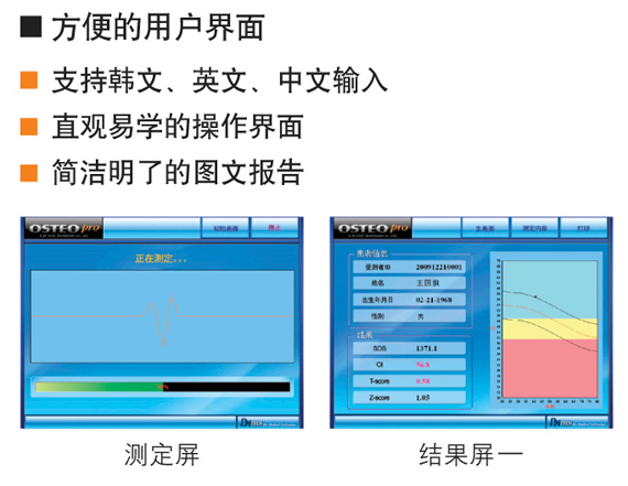 韩国骨密度仪特点